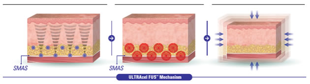 ウルトラセルQ+