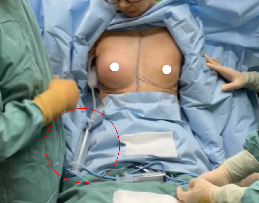 福岡の豊胸・バストアップのミラーチェック