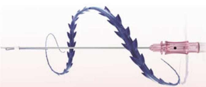 福岡の糸リフト（スレッドリフト）のブリッジリフト