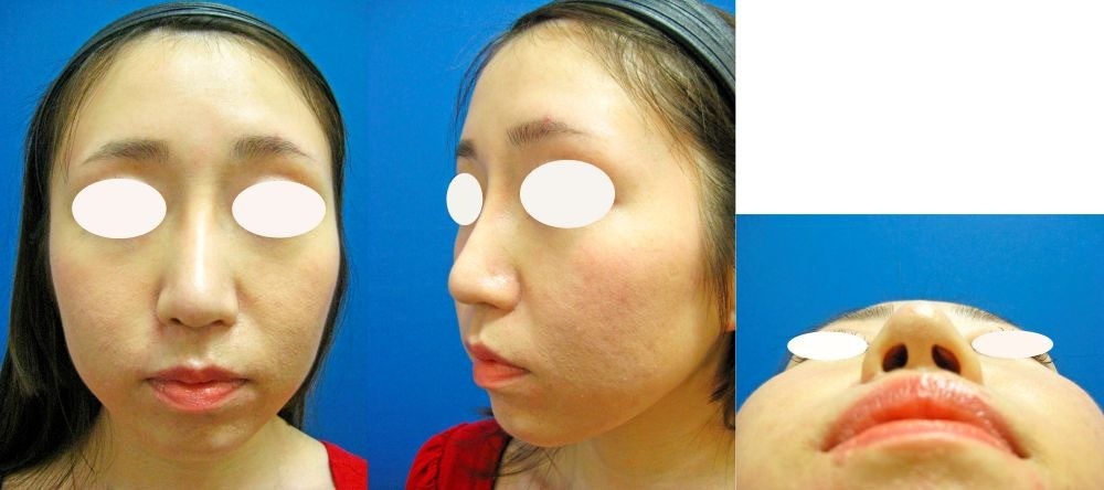 ff3daad03d2c06a334cae3c4747860d3-1755495944.jpg ff3daad03d2c06a334cae3c4747860d3-1755495944.jpg