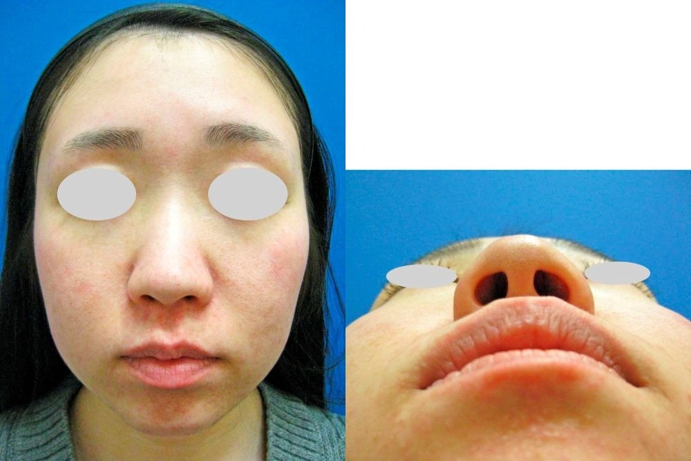 7bca96b0d7b51cd053047873ef1da9ba-1755500956.jpg 7bca96b0d7b51cd053047873ef1da9ba-1755500956.jpg