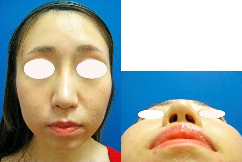 71eb131e2bddcc8057d4cb7065232989-1755500980.jpg 71eb131e2bddcc8057d4cb7065232989-1755500980.jpg