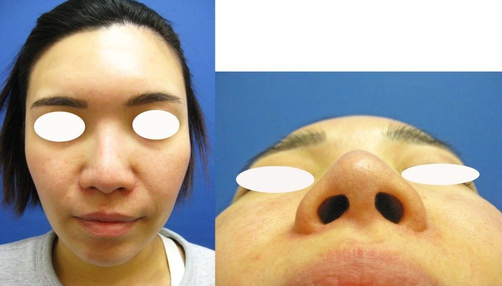 794a2c69b00133ea17ca639c3f3ad7be-1757397924.jpg 794a2c69b00133ea17ca639c3f3ad7be-1757397924.jpg