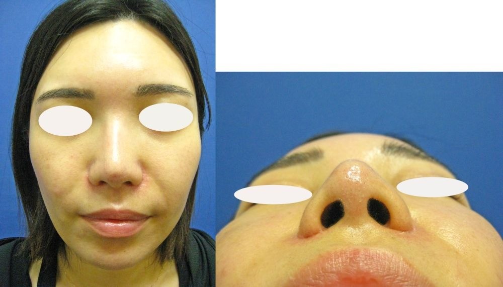 eedde9a46028c7d5b51ae5b1d5f0c10b-1757397951.jpg eedde9a46028c7d5b51ae5b1d5f0c10b-1757397951.jpg