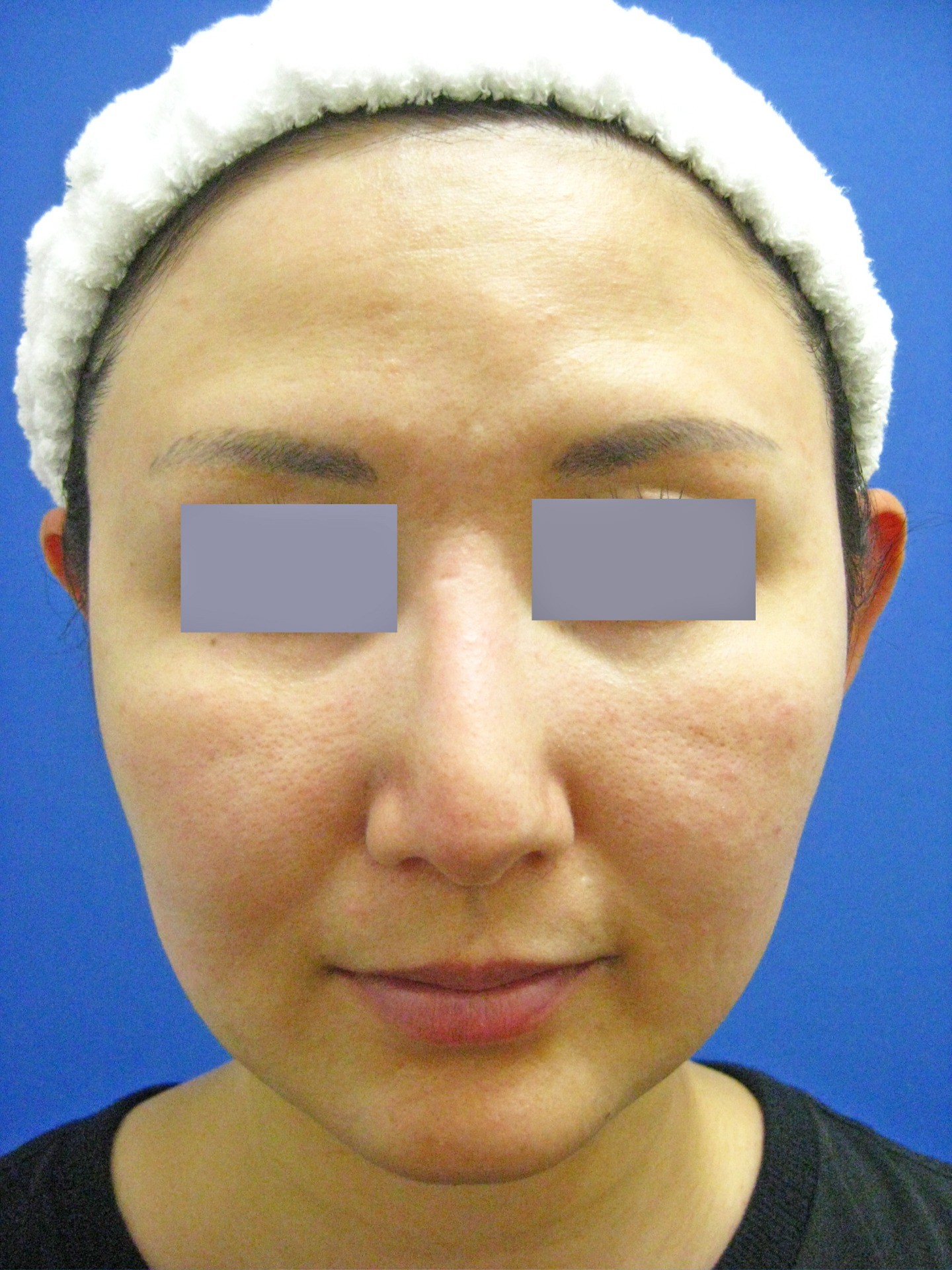 794a2c69b00133ea17ca639c3f3ad7be-1772341854.jpg 794a2c69b00133ea17ca639c3f3ad7be-1772341854.jpg