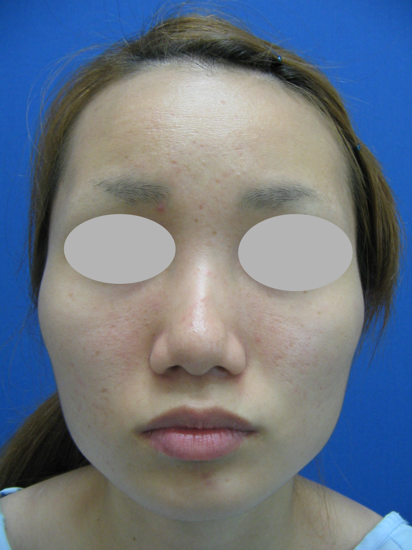 b5157cad7d0dfabb9e313aff81b4341b-1782791231.png
