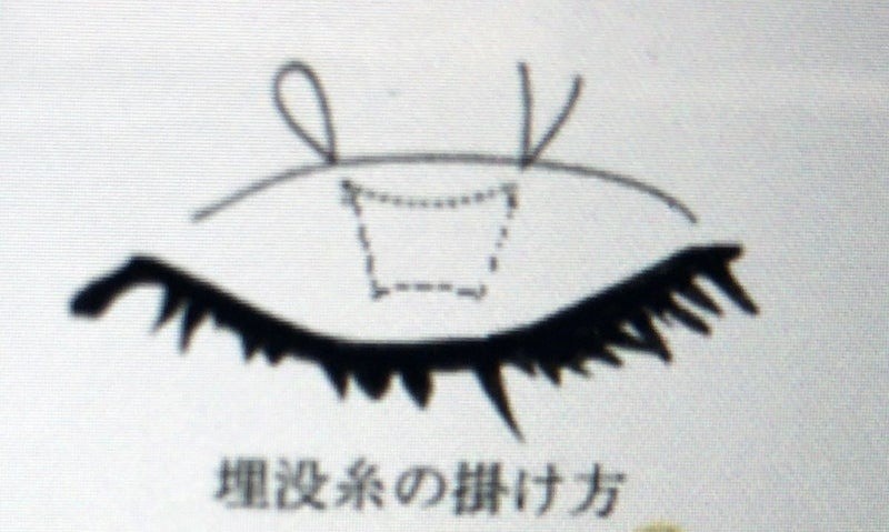 88262ddfc4fc38f8e5083694dc13486d-1788512851.jpg