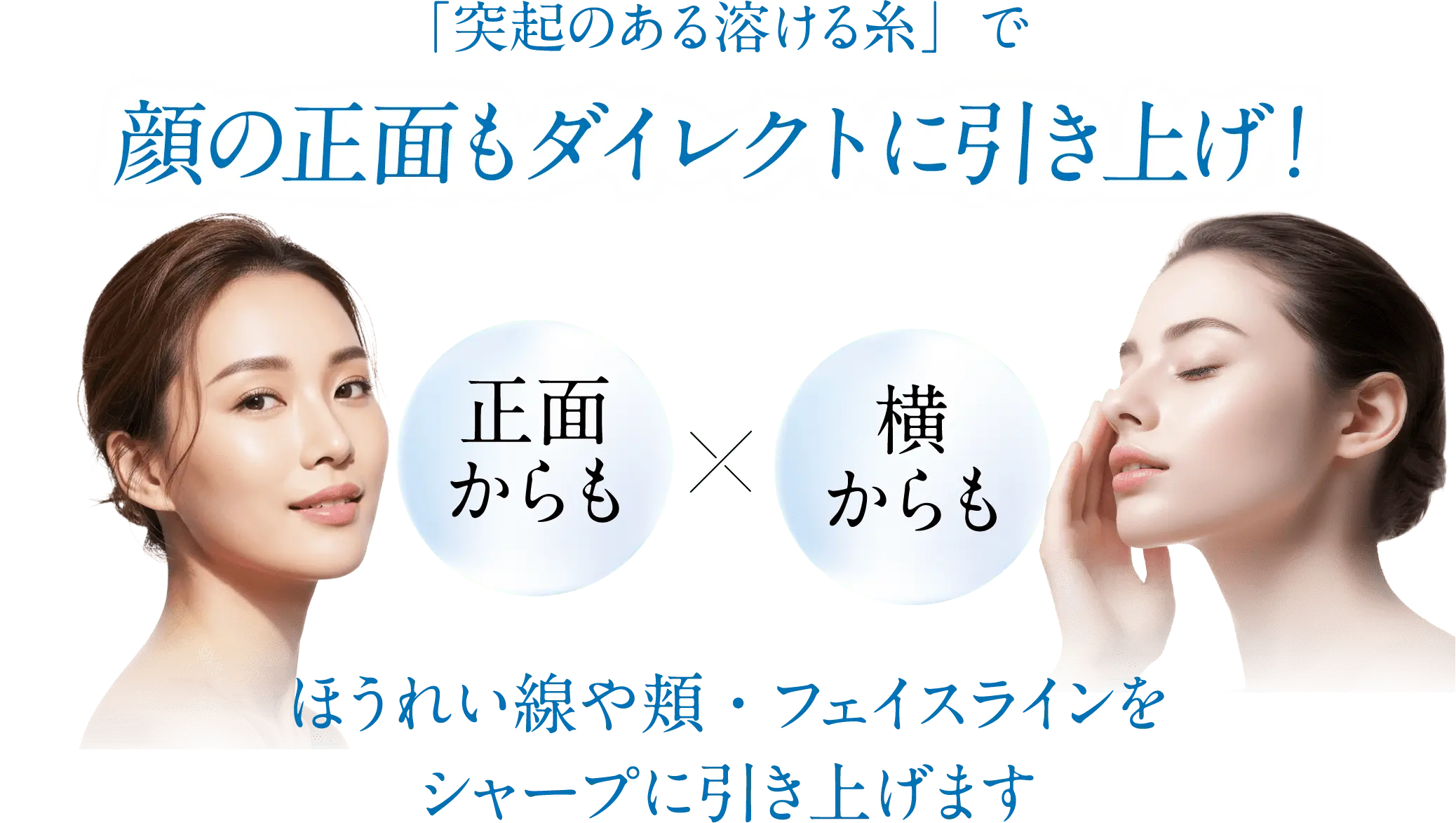 「突起のある溶ける糸」で顔の正面もダイレクトに引き上げ！ほうれい線や頬・フェイスラインをシャープに引き上げます