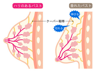 福岡で豊胸・バストアップ『人工乳腺法』
